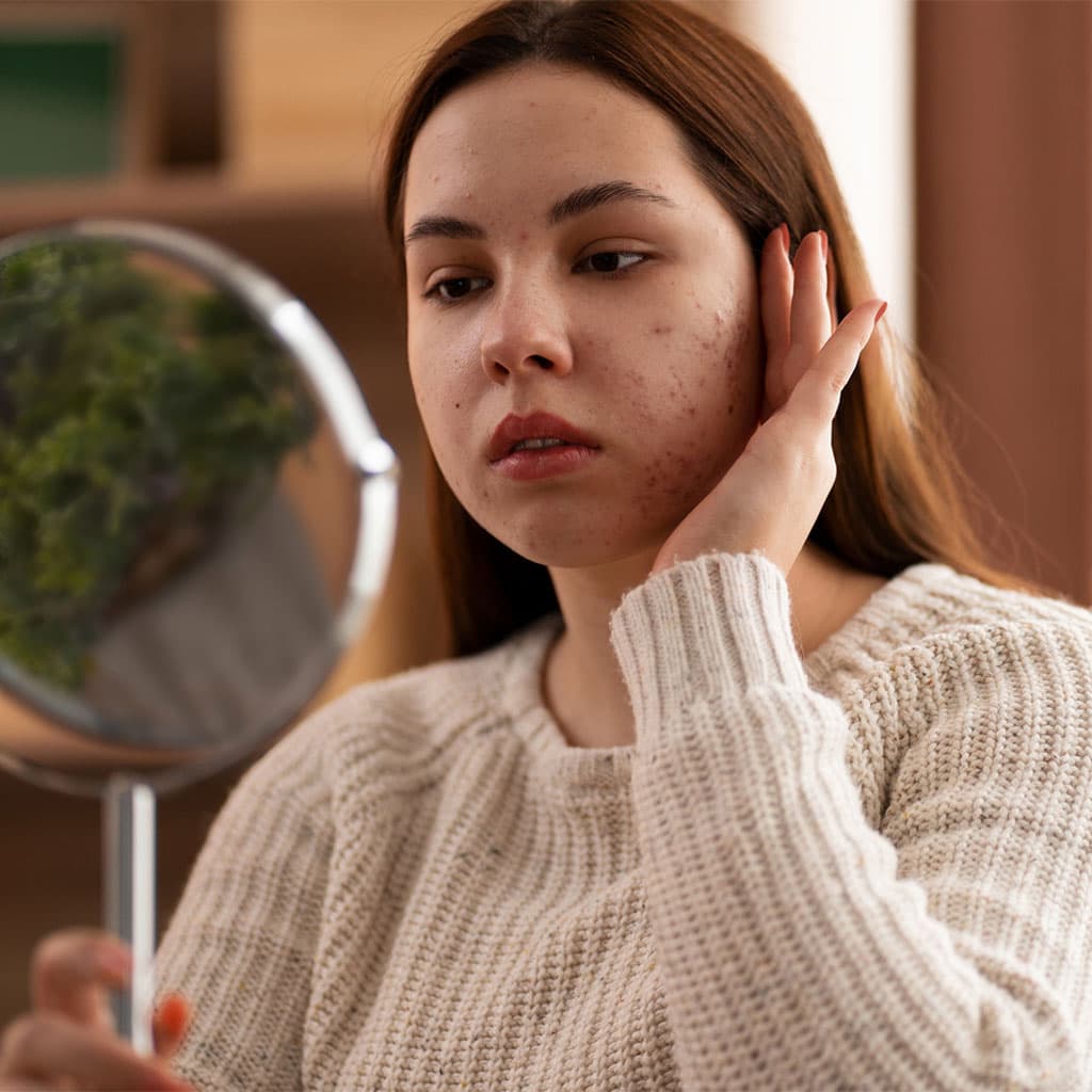 Young woman examining her skin in a mirror